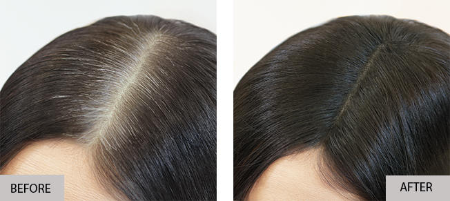 Insta Recharge regrowth concealing before and after